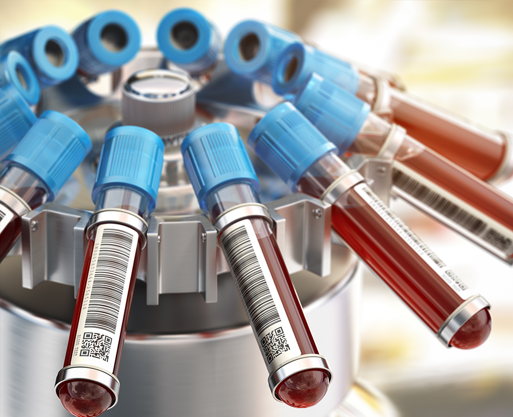 Visual representation of Antibody Testing